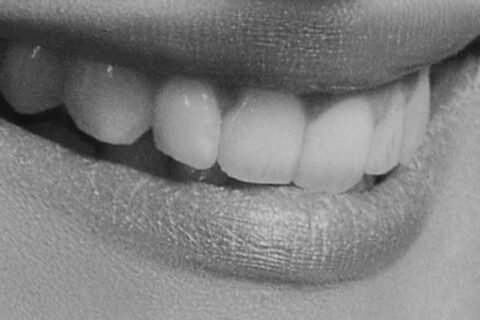 Teeth